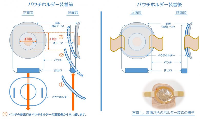 オストメイト用パウチホルダー キノキータ ジャパン